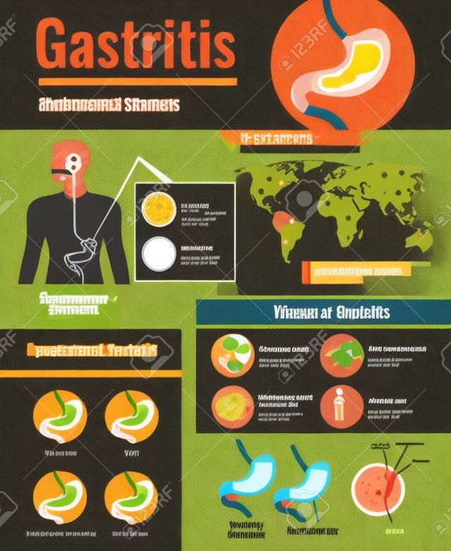 Gastritis symptoms stomach ulcer causes information on unhealthy food habits world population affected infographic poster  illustration