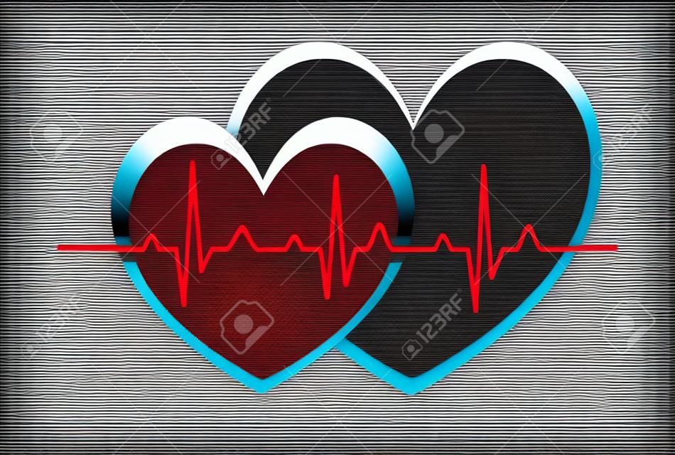 摘要心臟跳動的心電圖