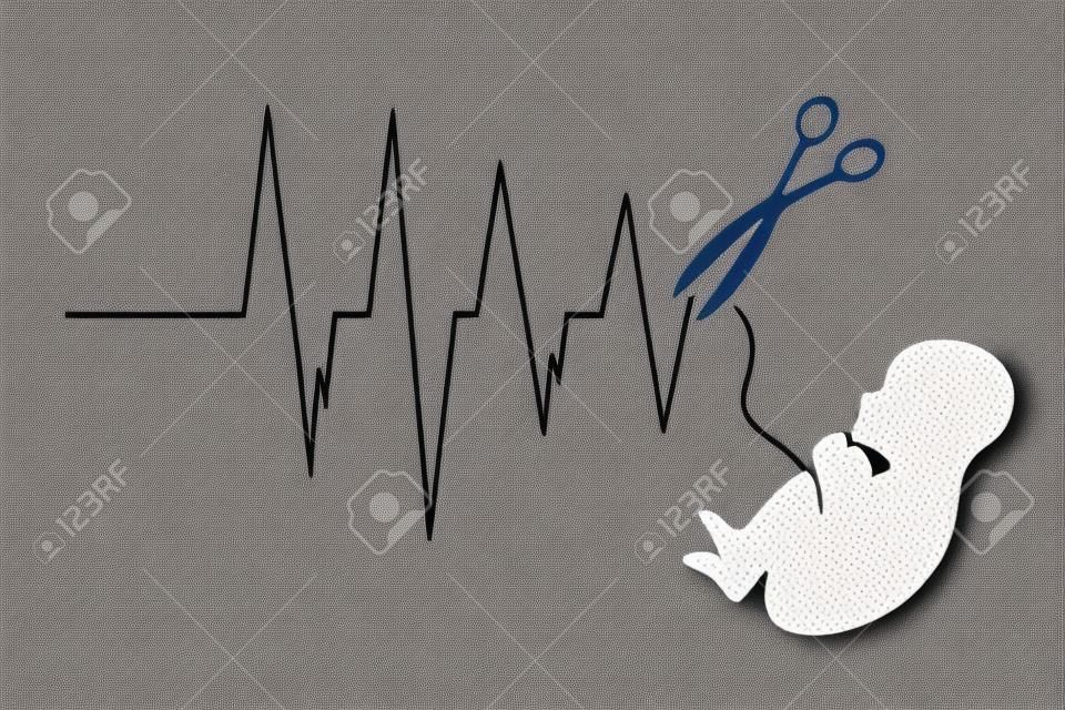 Vector illustration of abortion fetus with heart beat on white background. Sign of premature birth and miscarriage.