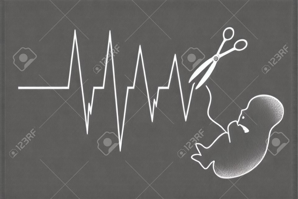 Illustrazione vettoriale del feto abortivo con battito cardiaco su priorità bassa bianca. Segno di parto prematuro e aborto spontaneo.