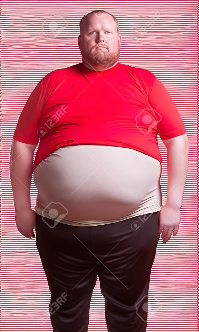 Obese man at 400lbs - front