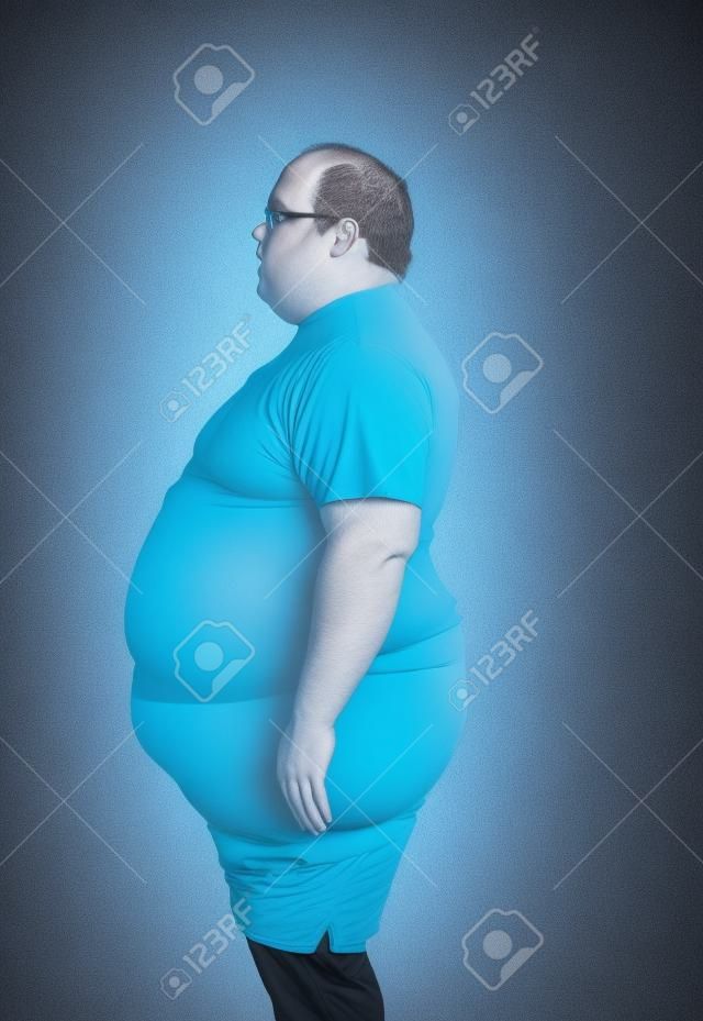 Obese man at 400lbs - left