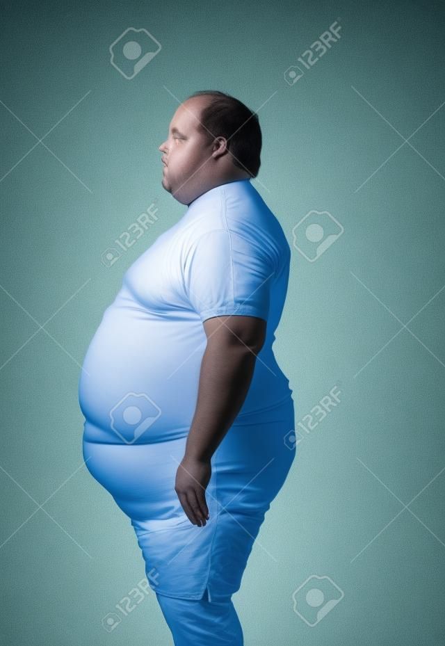Obese man at 400lbs - left