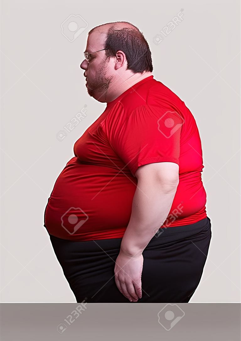 Homme obèse à 400 lb - gauche