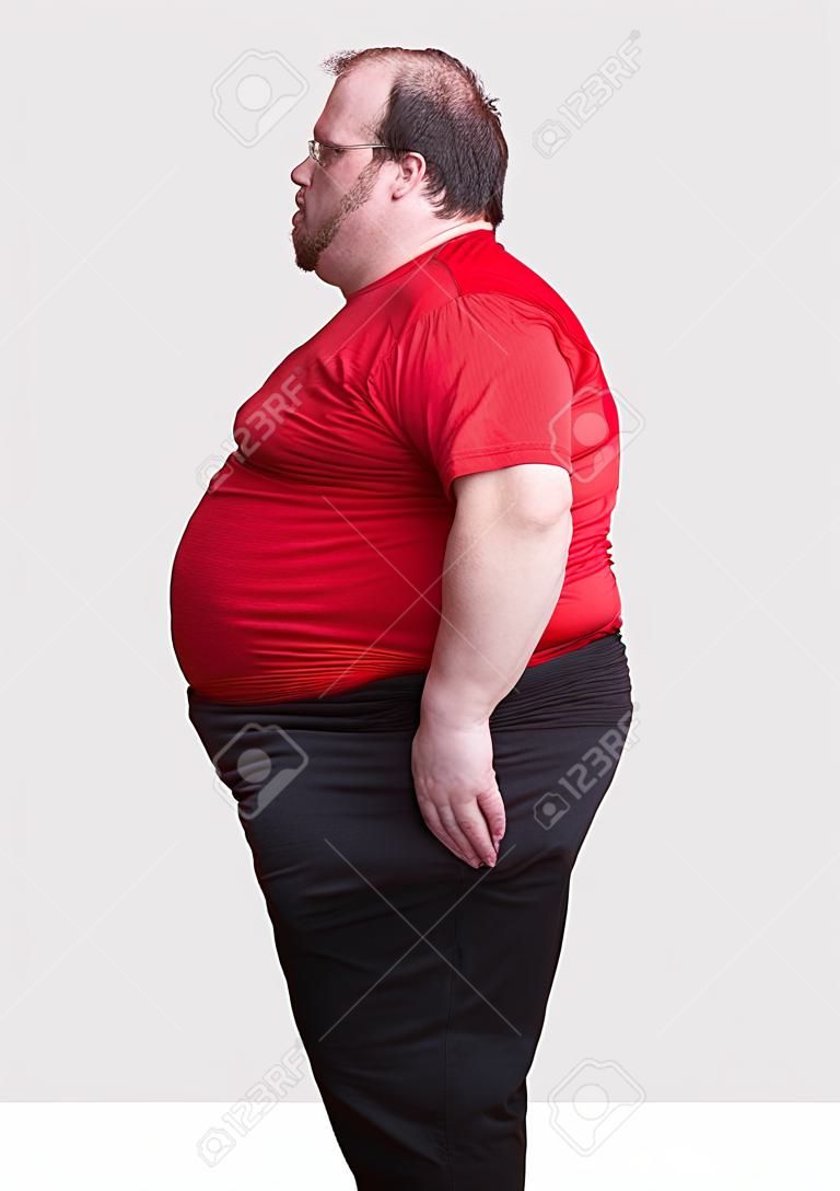 Homme obèse à 400 lb - gauche
