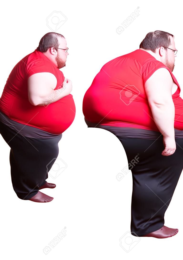 Hombre obeso 400 libras - derecha