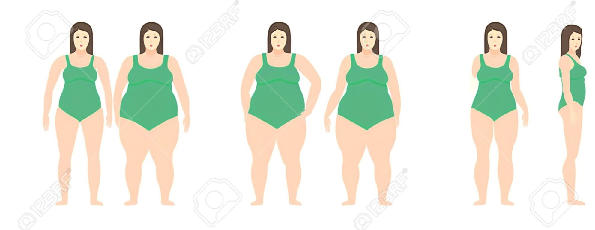 거식 증에서 매우 비만에 다른 무게를 가진 여자의 벡터 일러스트 레이 션. 체질량 지수, 체중 감량 개념.