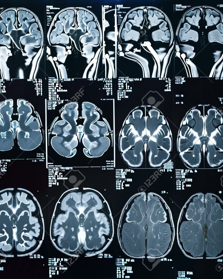 Skan MRI mózgu. Medycyna i zdrowie