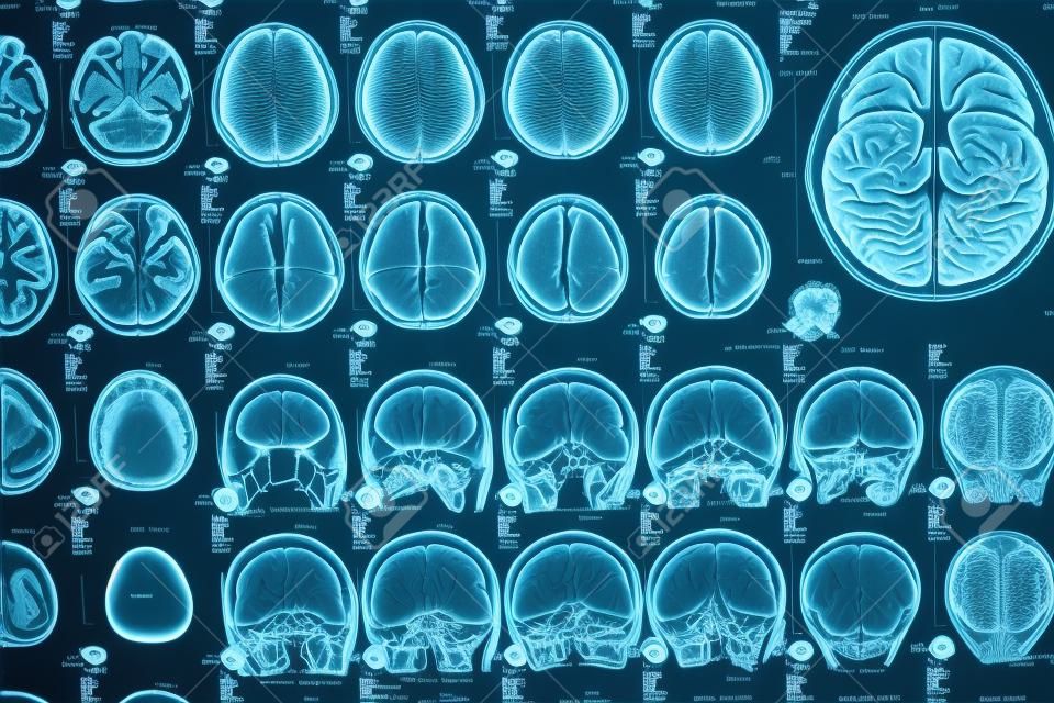 O raio-X da imagem de close-up do cérebro humano