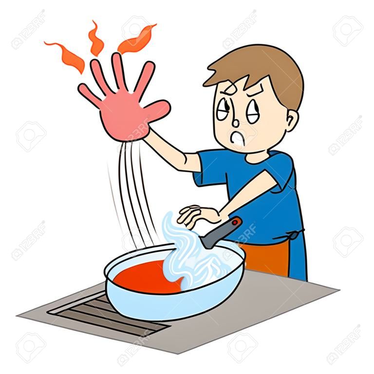 Het is een illustratie van een jongen die per ongeluk een pot raakte tijdens het koken en zijn hand verbrandde.