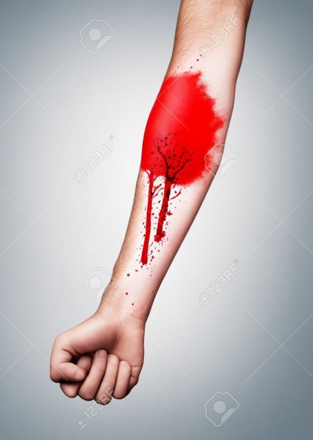 Homme bras avec veines de sang sur fond blanc, soins de santé et concept médical