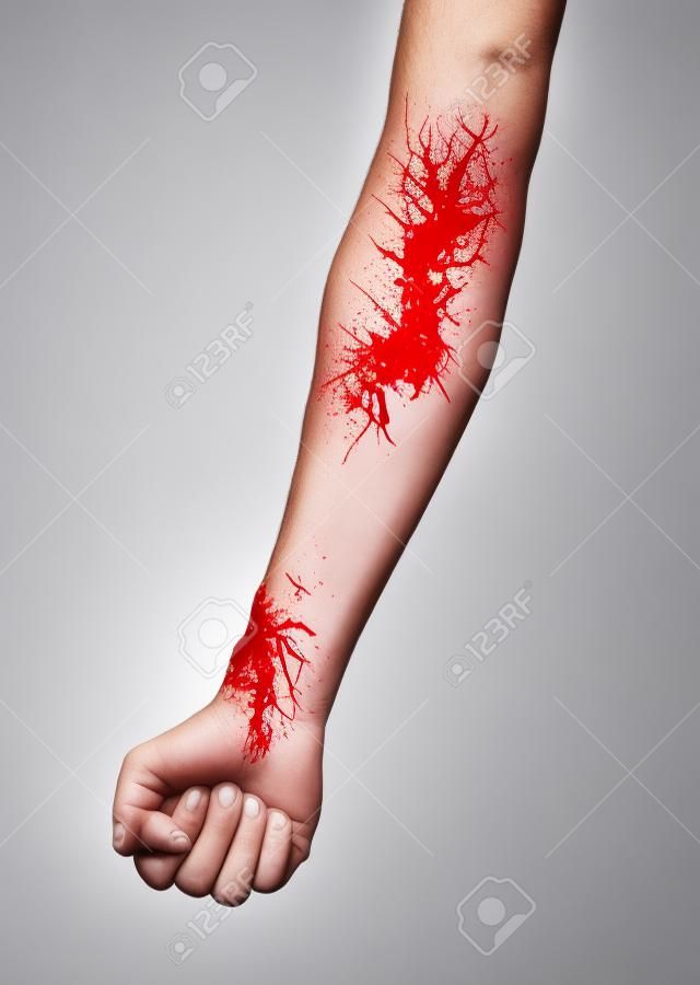 Homem, braço, com, veias sangue, ligado, fundo branco, cuidados de saúde, e, conceito médico
