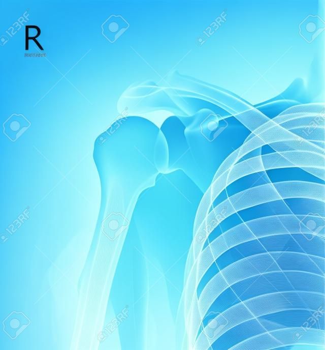 Röntgenschouderklier