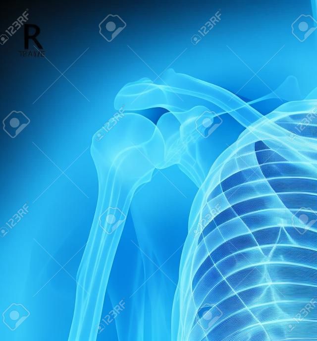 Röntgenschouderklier