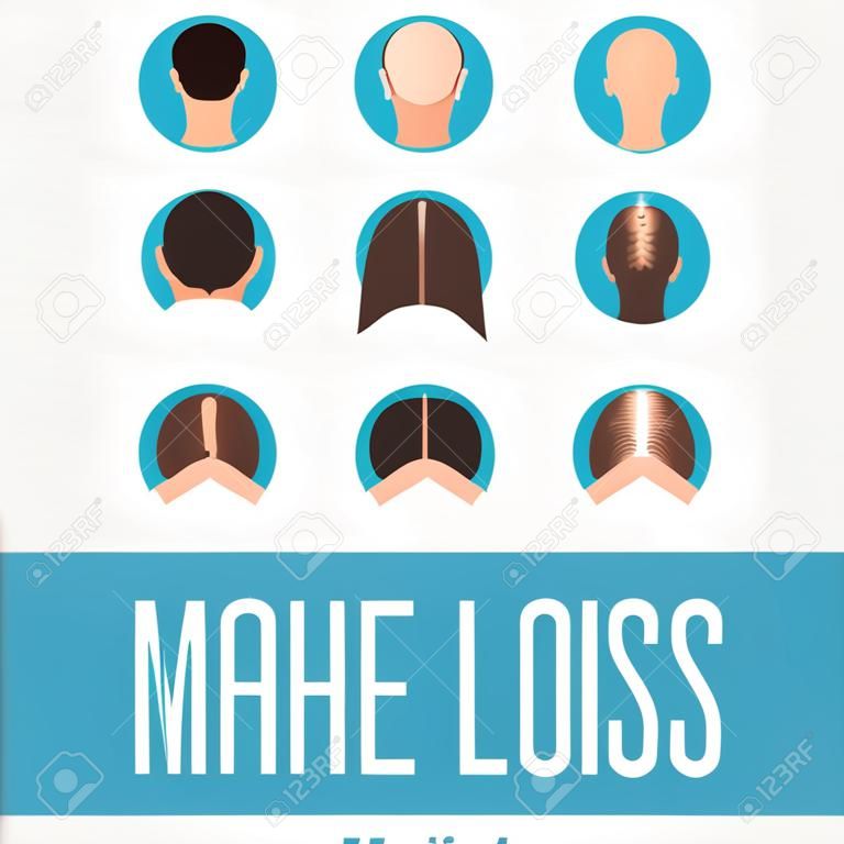 Male and female pattern hair loss set. Stages of baldness in men and women. Alopecia infographic medical design template. Hair loss clinic concept design. Vector illustration.