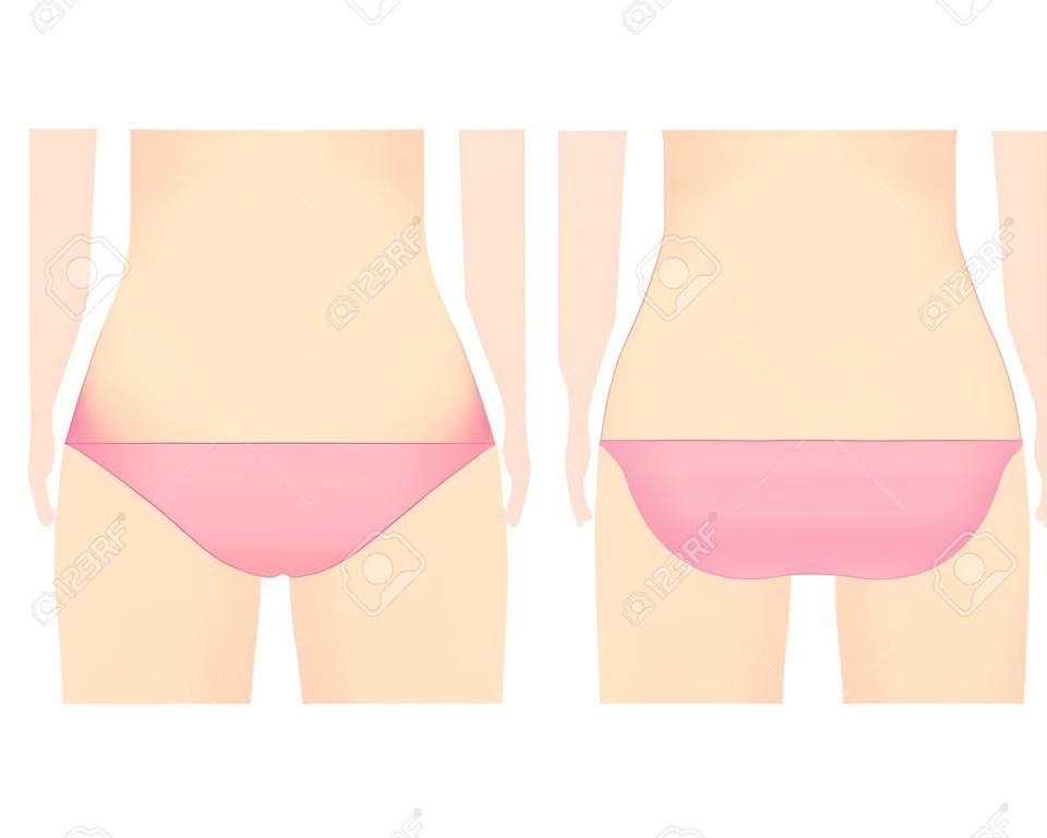 Body parts. VIO. Hair Removal. Female. Beauty. Vector illustration.
