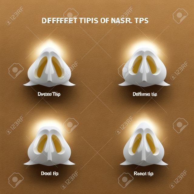 Diversi tipi di punte nasali