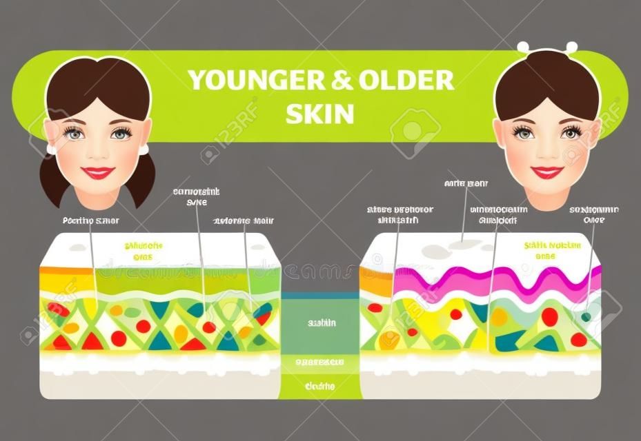 Oudere en jongere huid vergelijking diagram, vector illustratie schema, jong meisje en oudere dame gezicht.