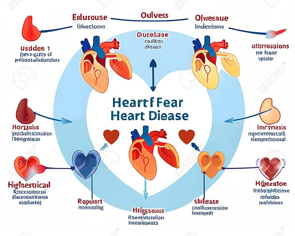 Types of heart disease collection, vector illustration diagram. Educational medical information.
