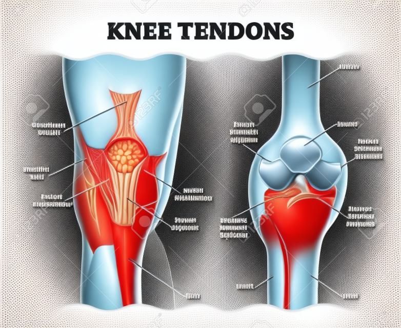 Knie Tendons medische vector illustratie schema, anatomische diagram. Educatieve informatie.