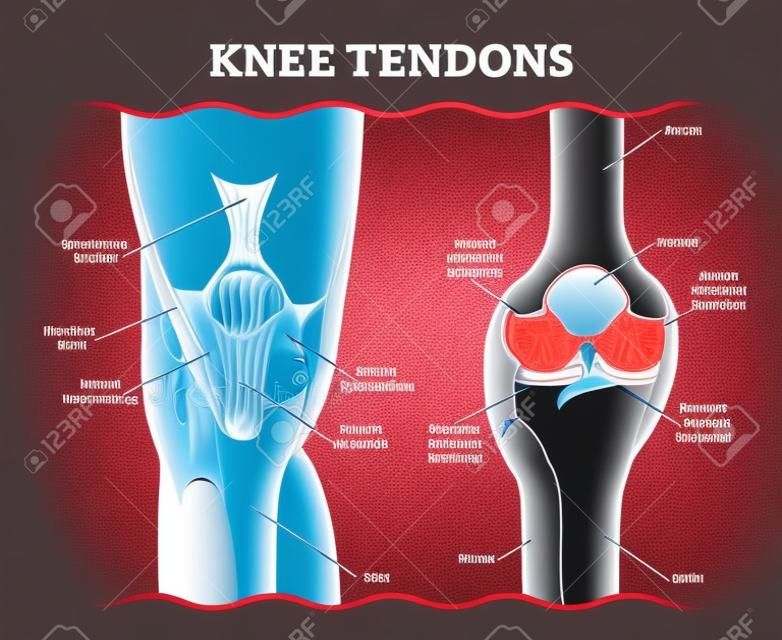 Knie Tendons medische vector illustratie schema, anatomische diagram. Educatieve informatie.