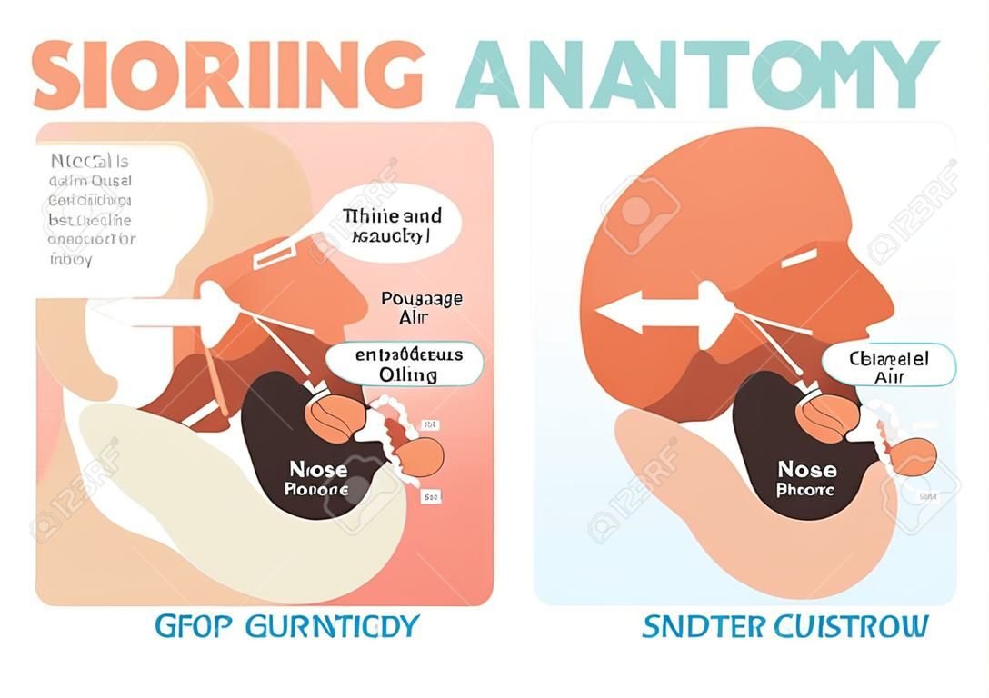 Horkolás anatómia orvosi vektor diagram orr, száj, nyelv és levegő járat.