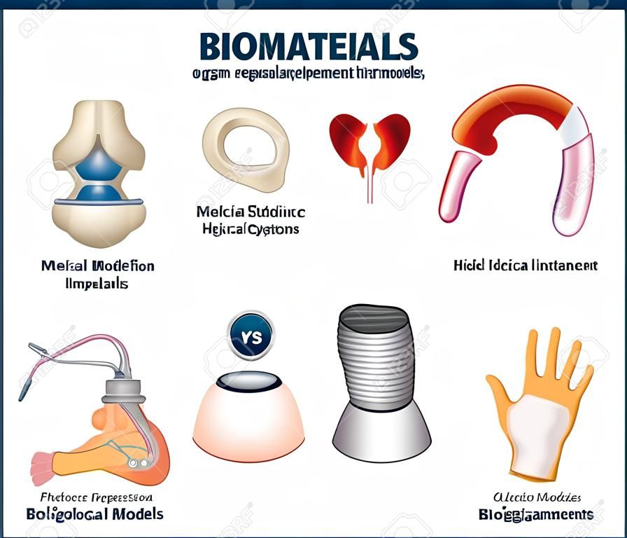 Ilustración vectorial de biomateriales. Equipo de recolección de reemplazo de órganos etiquetado. Sustancia médica para la interacción de sistemas biológicos en el cuidado de la salud. Tecnología de modelos de reemplazos, válvulas e implantes.