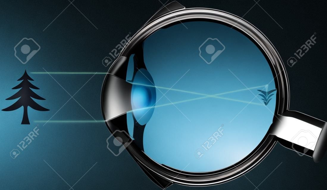 visão, globo ocular, óptica, sistema de lentes