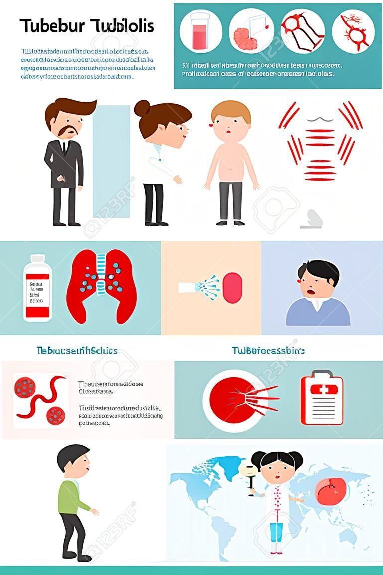 Туберкулез элемент инфографика, Медицина и здравоохранение инфографики, туберкулез, туберкулез вектор инфографики, набор элементов и символы для дизайна, вектор illustration.tb,