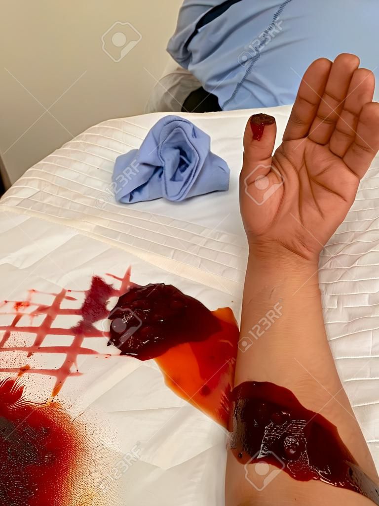 Main sanglante coupée par une scie dans une main blessée après un accident de travail dans l'atelier de menuiserie.