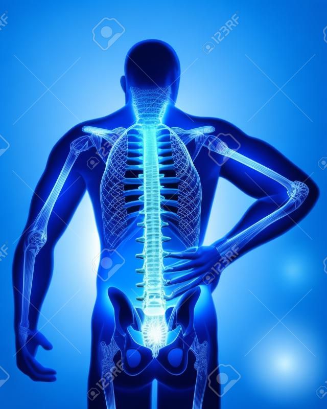 Rückenschmerzen in blau