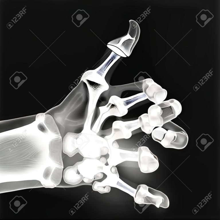 X-ray di pollice in su
