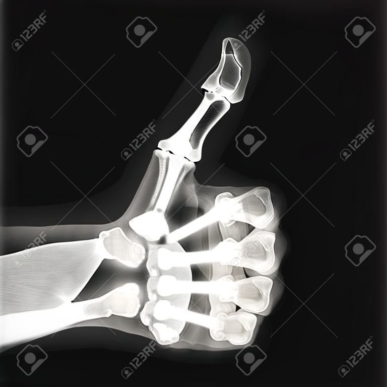 X-ray of thumb up