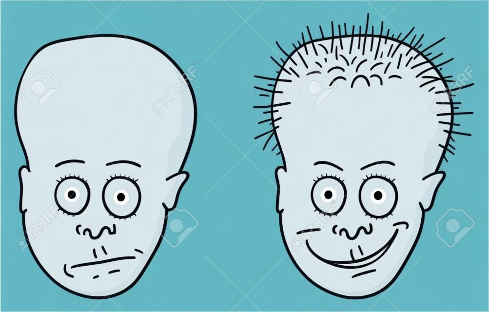 Illustration vectorielle comique - un patient avec une tête chauve et croissant de cheveux