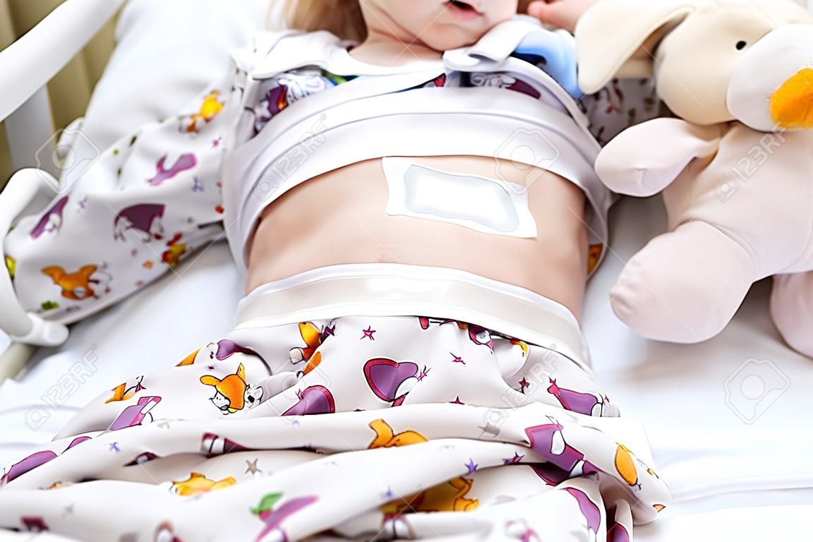小女孩闌尾手術後在她的腹部和導管上有醫療補丁。