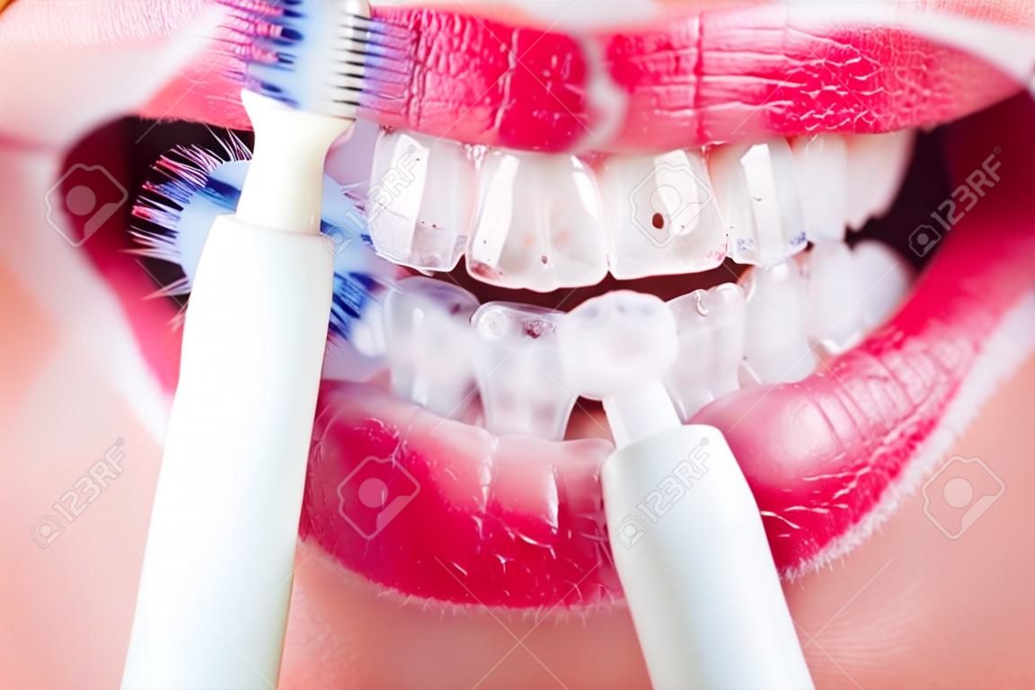 white teeth are brushed with an electric toothbrush
