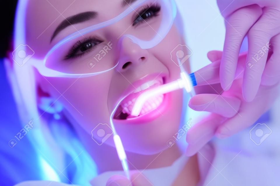 Close-up portret van een vrouwelijke patiënt bij tandarts in de kliniek. Tanden bleken procedure met ultraviolet licht UV-lamp.