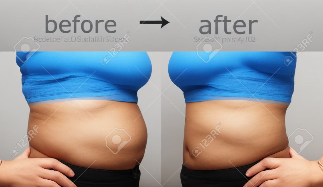 Woman's body before and after a diet