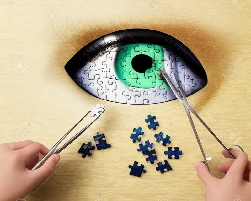 Conceito de quebra-cabeça de operação ocular (correção de visão):