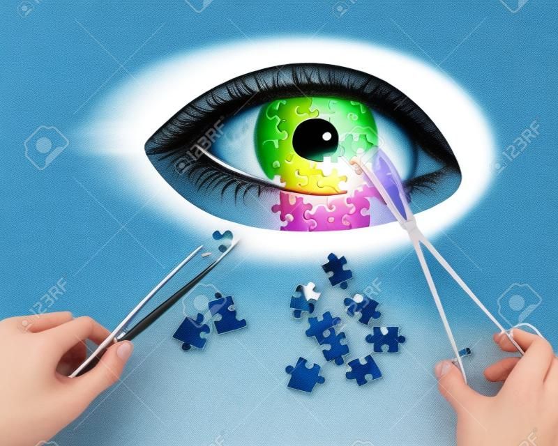 Conceito de quebra-cabeça de operação ocular (correção de visão):