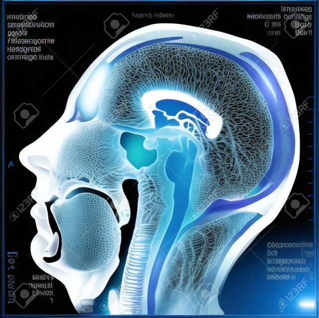 La resonancia magnética, la imagen de la cabeza en diferentes planos
