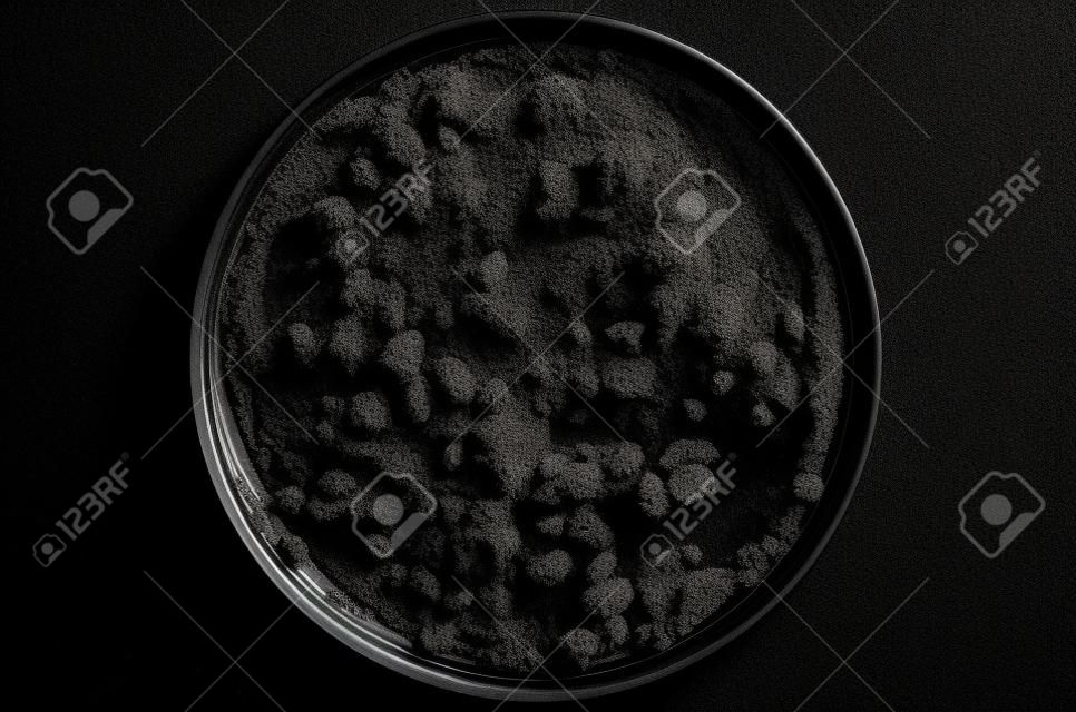 Vista superior de los microorganismos del suelo Agar nutritivo en placa sobre fondo negro.