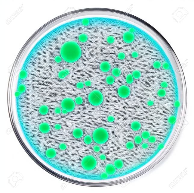 Different color, size and type colonies of bacteria from public premises air on a petri dish agar plate isolated on white background by pen tool. Nutrient agar media used. Focus on full depth.