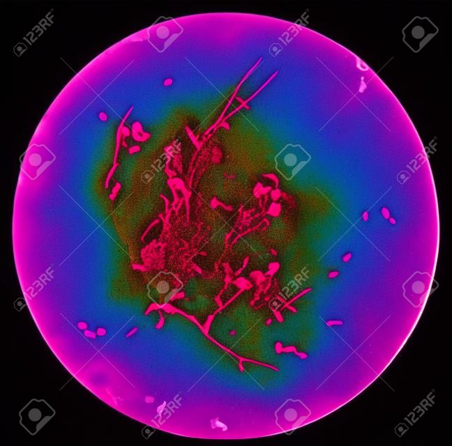 Esfregaço de sangue humano cultivado Gram's manchado sob microscópio de luz 100x com hifas e células de levedura