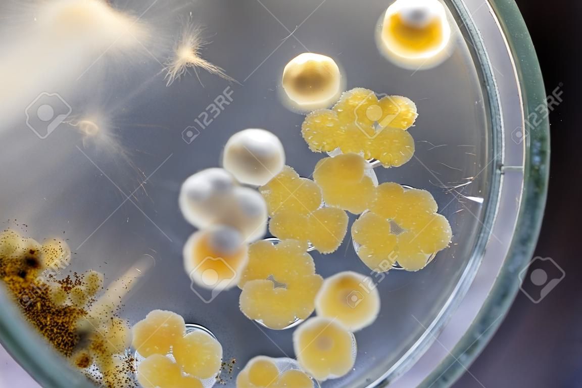 Colonia característica de Actinomyces, Bactérias, leveduras e mofo em meios seletivos de amostras de solo para estudo em microbiologia de laboratório.