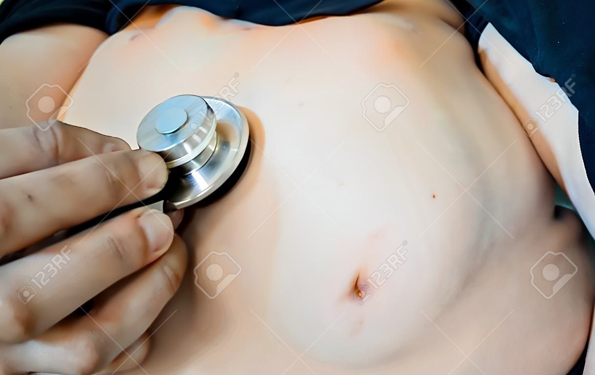Stethoscope concept of fat children with belly