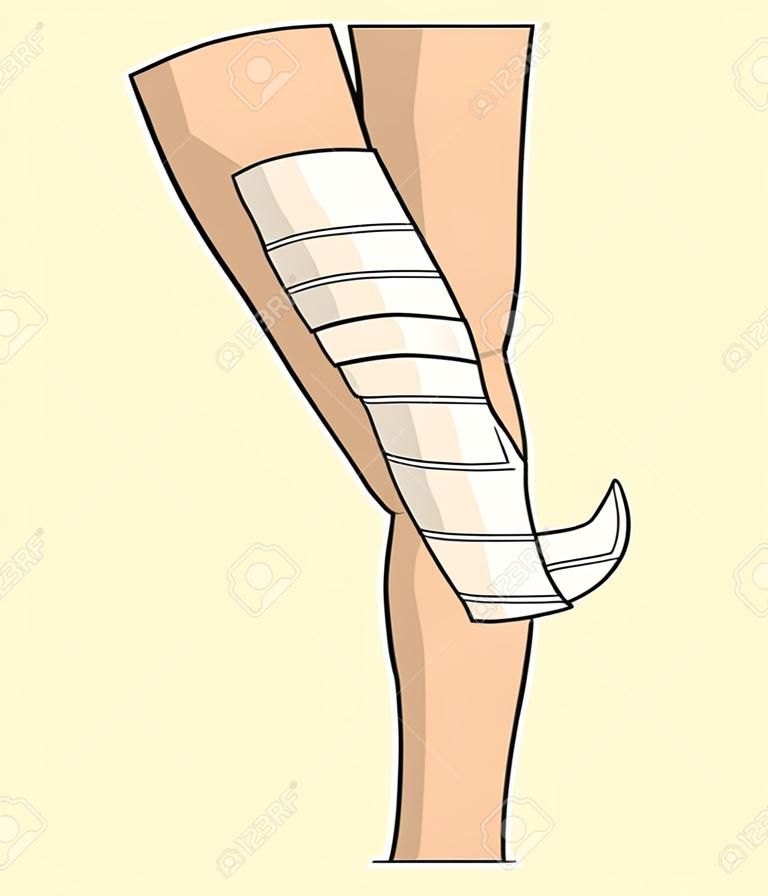 Bandageamento joelho bandagem elástica lesão articular perna trauma primeiro vetor de primeiros socorros isolado parte do corpo humano medicina tratamento de traumatologia e entorse de saúde menisco danos de emergência ajuda dor ou dor.