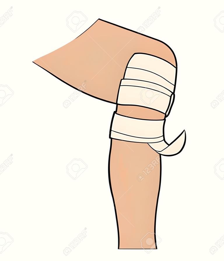 Bendaggio bendaggio elastico al ginocchio infortunio articolare trauma gamba primo soccorso vettore isolato parte del corpo umano medicina traumatologia trattamento e assistenza sanitaria distorsione menisco danno emergenza aiuto dolore o dolore.
