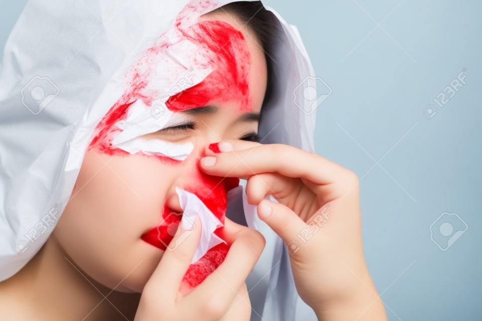 Nasenbluten, eine junge Frau, die an Nasenbluten leidet und Seidenpapier verwendet, um Blutungen zu stoppen. Gesundheitswesen und medizinisches Konzept.
