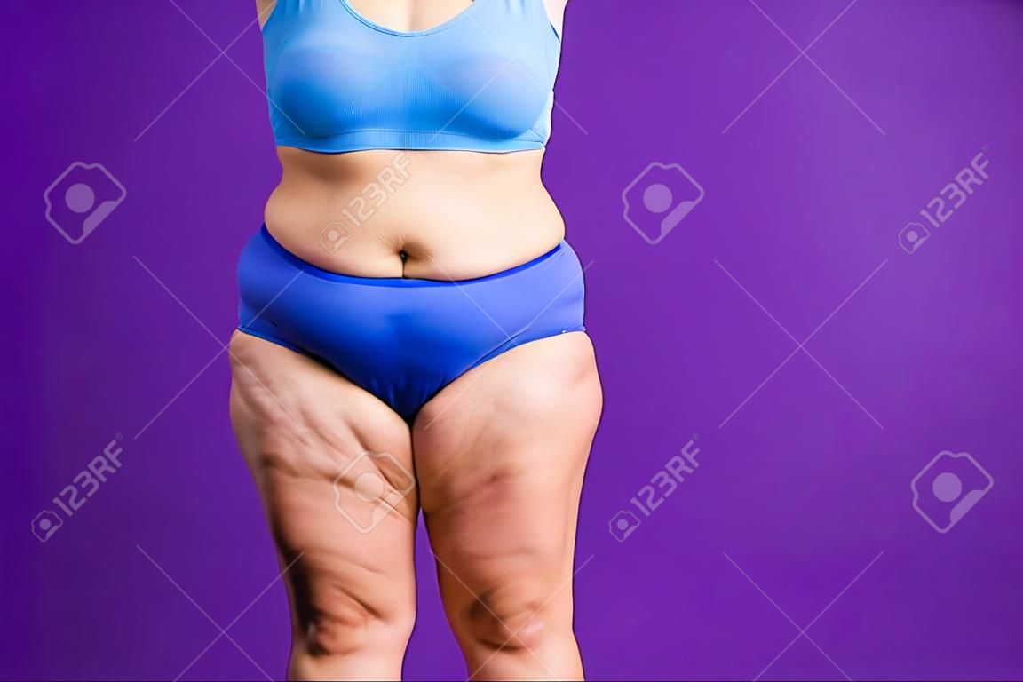 Tummy tuck, flabby skin on a fat belly, plastic surgery concept on purple background